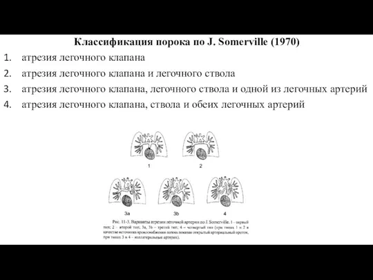 Классификация порока по J. Somerville (1970) атрезия легочного клапана атрезия легочного клапана и