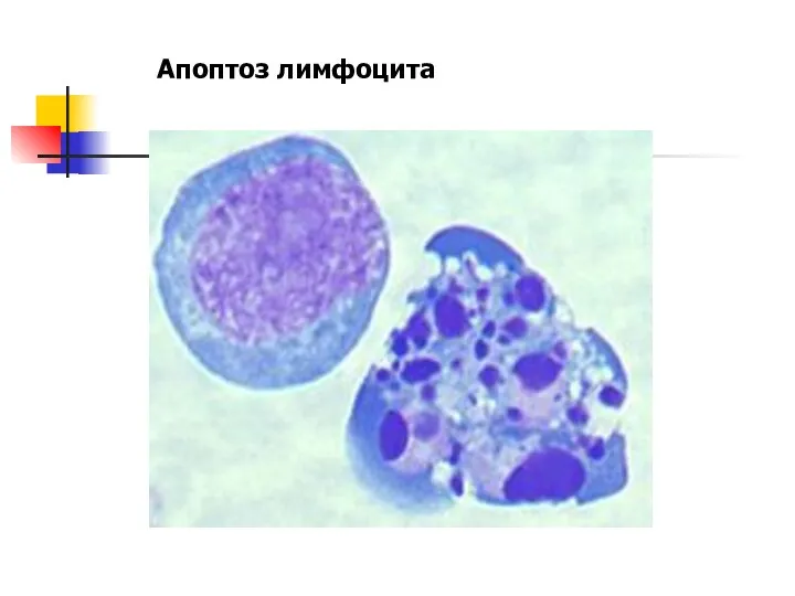Апоптоз лимфоцита