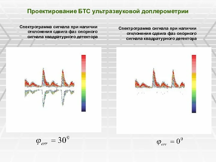 Проектирование БТС ультразвуковой доплерометрии Спектрограмма сигнала при наличии отклонения сдвига