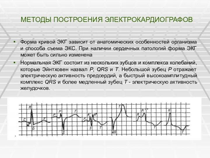 МЕТОДЫ ПОСТРОЕНИЯ ЭЛЕКТРОКАРДИОГРАФОВ Форма кривой ЭКГ зависит от анатомических особенностей