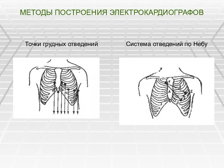 МЕТОДЫ ПОСТРОЕНИЯ ЭЛЕКТРОКАРДИОГРАФОВ Система отведений по Небу Точки грудных отведений