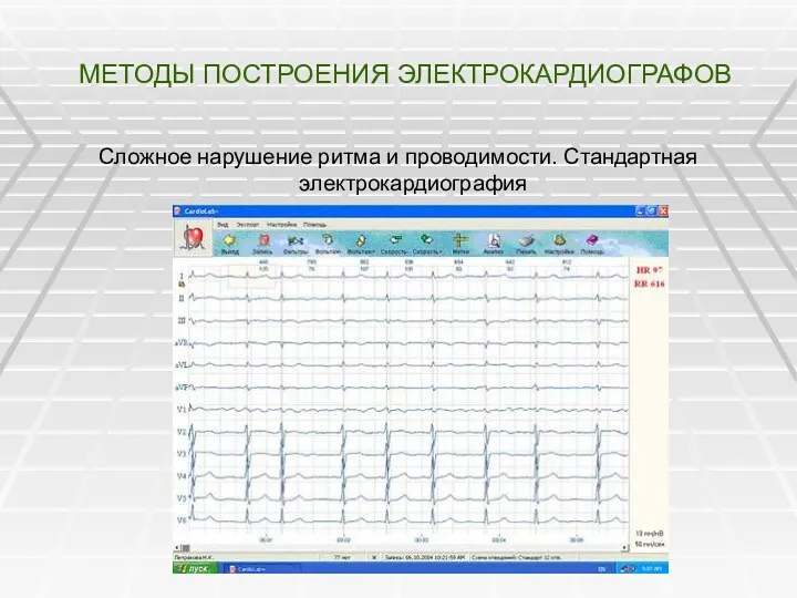 МЕТОДЫ ПОСТРОЕНИЯ ЭЛЕКТРОКАРДИОГРАФОВ Сложное нарушение ритма и проводимости. Стандартная электрокардиография