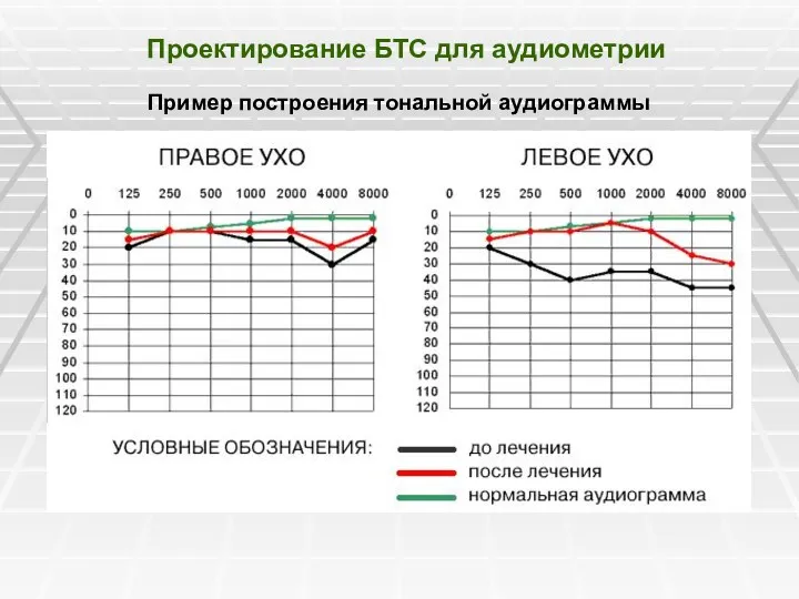 Проектирование БТС для аудиометрии Пример построения тональной аудиограммы