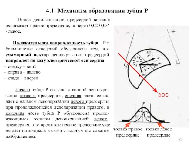 4.1. Механизм образования зубца P Волна деполяризации предсердий вначале охватывает