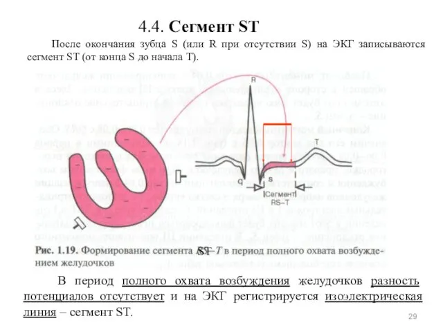 4.4. Сегмент ST После окончания зубца S (или R при