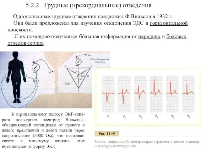 5.2.2. Грудные (прекордиальные) отведения Однополюсные грудные отведения предложил Ф.Вильсон в