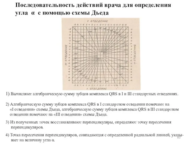 1) Вычисляют алгебраическую сумму зубцов комплекса QRS в I и