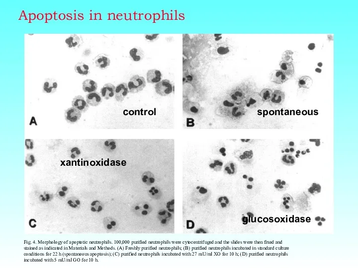 Apoptosis in neutrophils Fig. 4. Morphology of apoptotic neutrophils. 100,000 purified neutrophils were