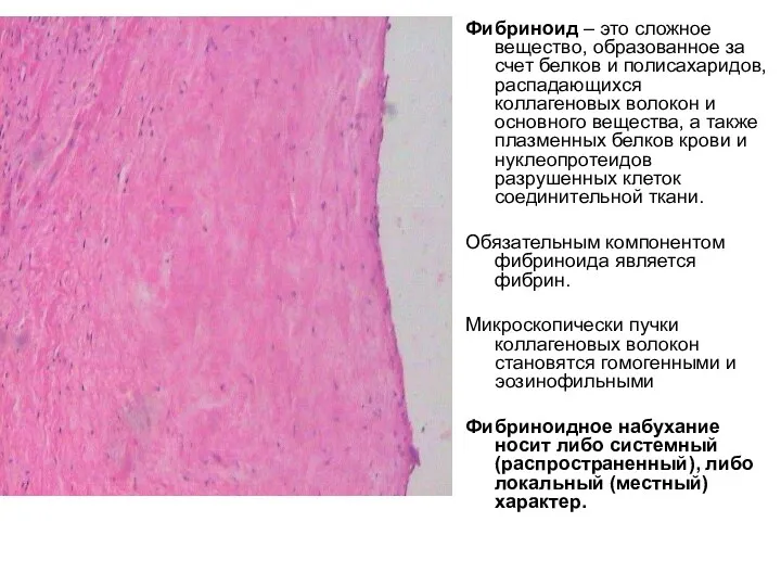 Фибриноид – это сложное вещество, образованное за счет белков и полисахаридов, распадающихся коллагеновых