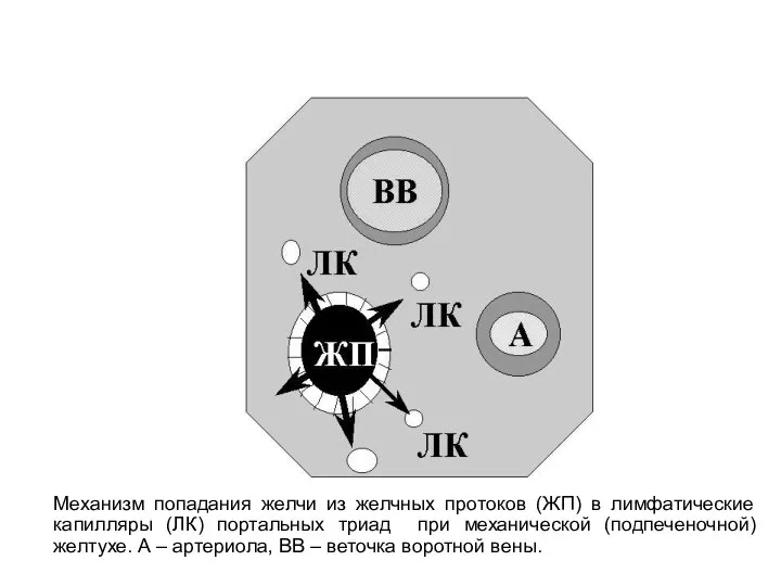 Механизм попадания желчи из желчных протоков (ЖП) в лимфатические капилляры (ЛК) портальных триад