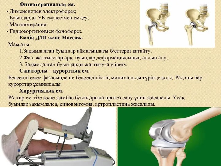 Физиотерапиялық ем. Дименсидпен электрофорез; Буындарды УК сәулесімен емдеу; Магниотерапия; Гидрокортизонмен