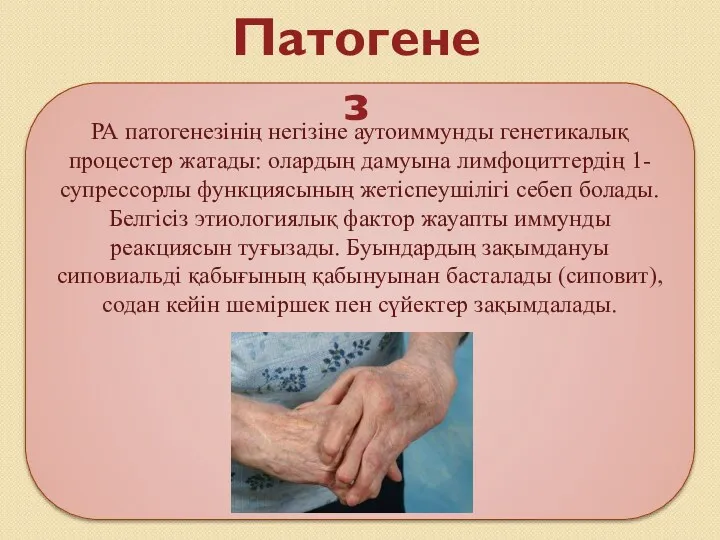 РА патогенезінің негізіне аутоиммунды генетикалық процестер жатады: олардың дамуына лимфоциттердің