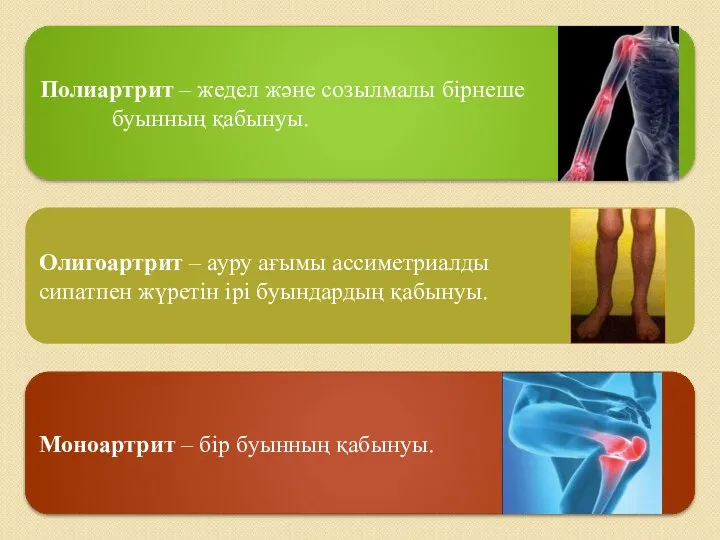 Полиартрит – жедел және созылмалы бірнеше буынның қабынуы. Олигоартрит –