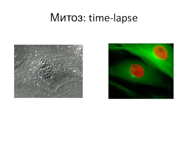 Митоз: time-lapse