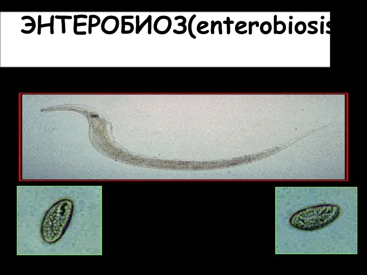 ЭНТЕРОБИОЗ(enterobiosis) Как известно, наиболее массовой паразитарной инвазией является энтеробиоз (около 200 000 зарегистрированных