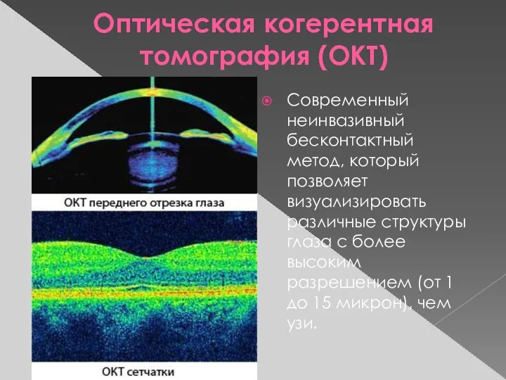 Оптическая когерентная томография (OКT) Современный неинвазивный бесконтактный метод, который позволяет