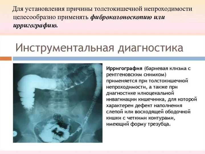 Для установления причины толстокишечной непроходимости целесообразно применять фиброколоноскопию или ирригографию.