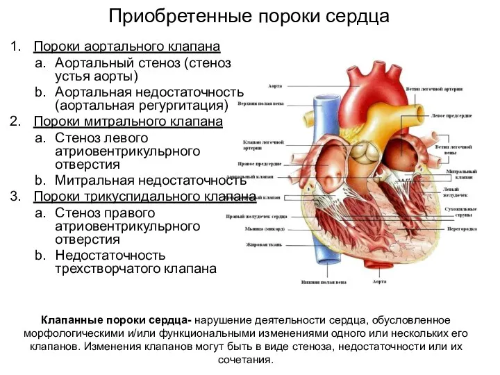 Пороки аортального клапана Аортальный стеноз (стеноз устья аорты) Аортальная недостаточность