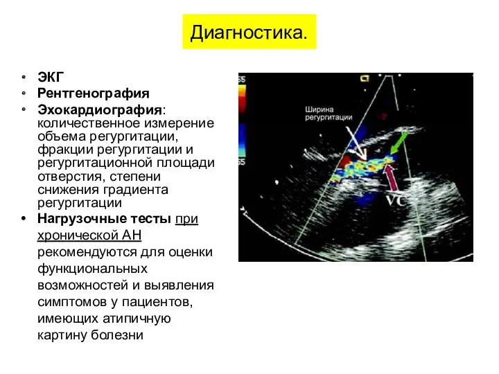 ЭКГ Рентгенография Эхокардиография: количественное измерение объема регургитации, фракции регургитации и