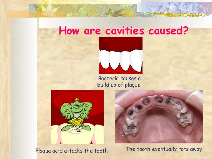 How are cavities caused? Bacteria causes a build up of