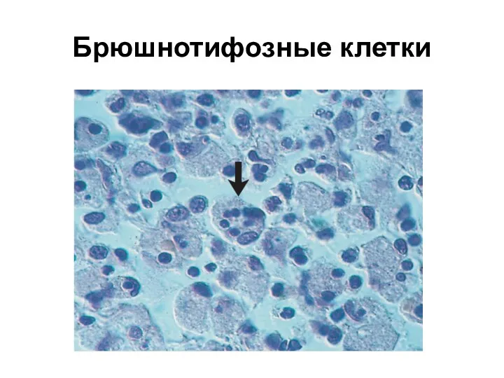 Брюшнотифозные клетки