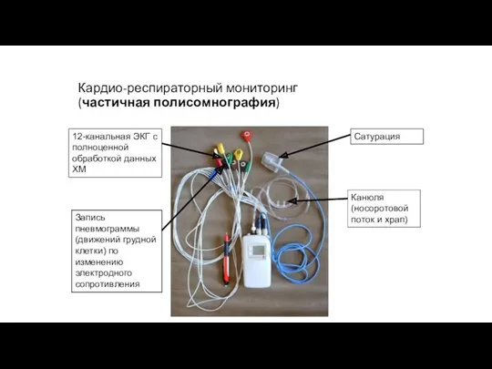 Кардио-респираторный мониторинг (частичная полисомнография) Сатурация Канюля (носоротовой поток и храп)