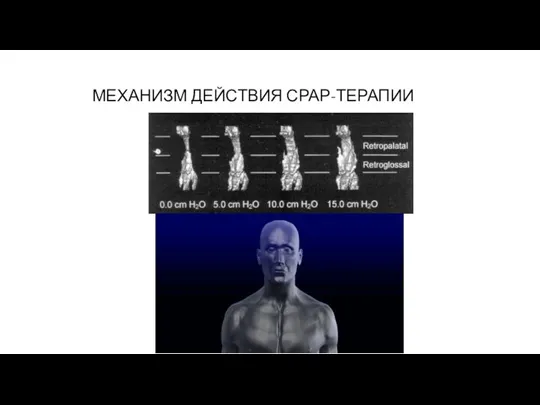 МЕХАНИЗМ ДЕЙСТВИЯ СРАР-ТЕРАПИИ