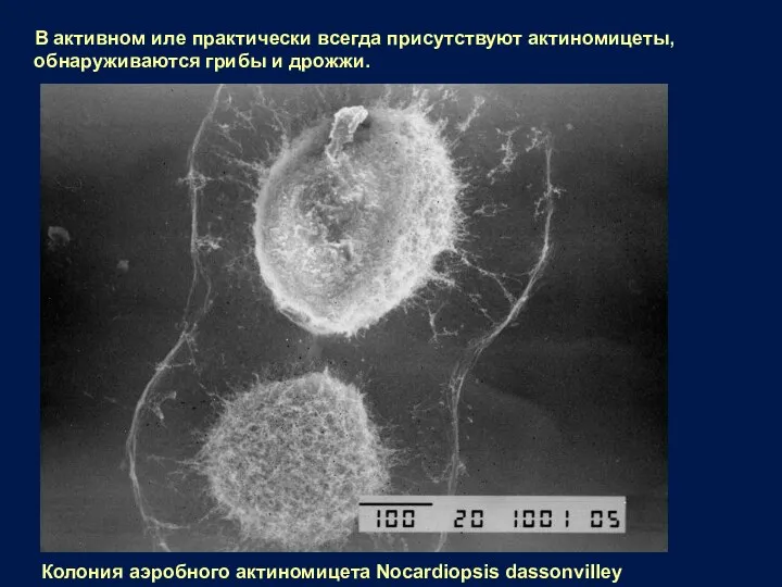 В активном иле практически всегда присутствуют актиномицеты, обнаруживаются грибы и дрожжи. Колония аэробного актиномицета Nocardiopsis dassonvilley