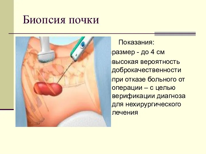 Биопсия почки Показания: размер - до 4 см высокая вероятность доброкачественности при отказе