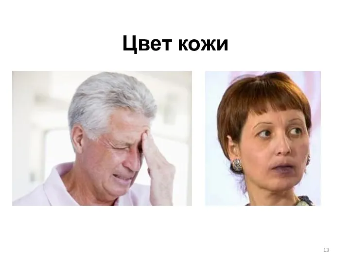 Цвет кожи