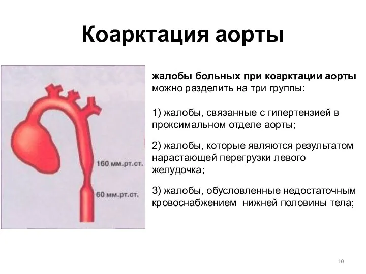 Коарктация аорты жалобы больных при коарктации аорты можно разделить на три группы: 1)