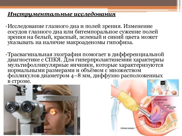 Инструментальные исследования Исследование глазного дна и полей зрения. Изменение сосудов