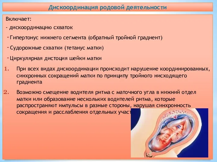 Дискоординация родовой деятельности Включает: - дискоординацию схваток Гипертонус нижнего сегмента (обратный тройной градиент)