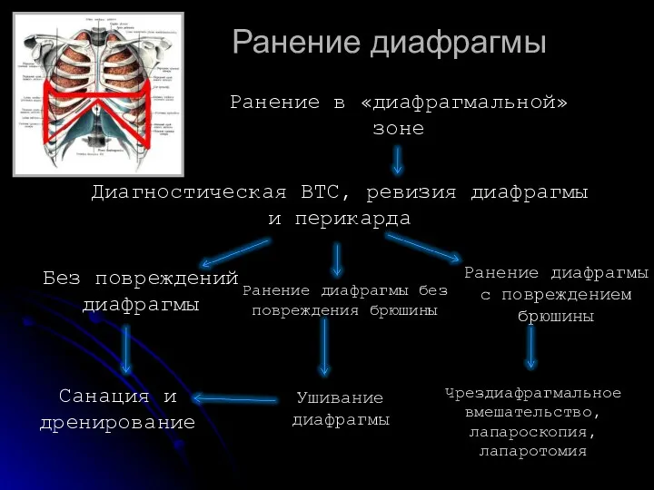 Ранение диафрагмы Ранение в «диафрагмальной» зоне Диагностическая ВТС, ревизия диафрагмы