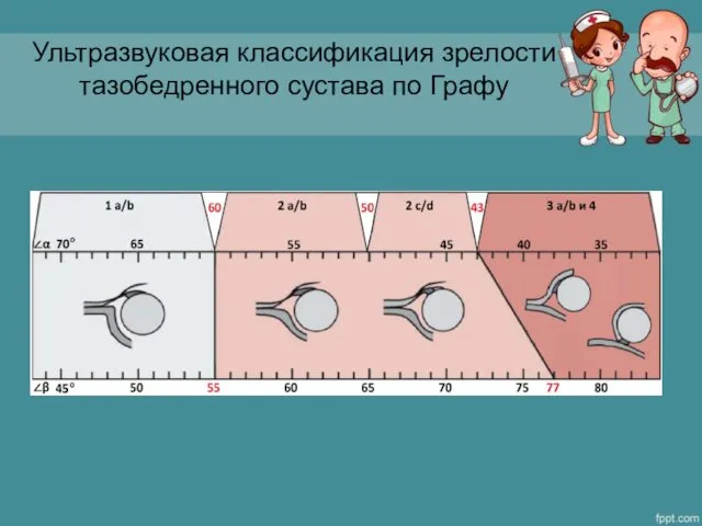 Ультразвуковая классификация зрелости тазобедренного сустава по Графу