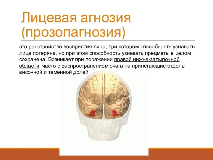 Лицевая агнозия (прозопагнозия) это расстройство восприятия лица, при котором способность