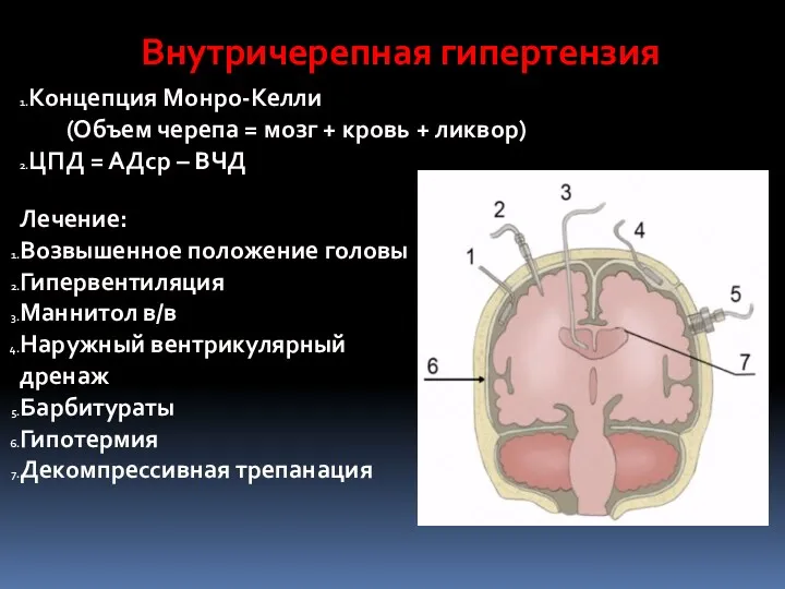 Внутричерепная гипертензия Лечение: Возвышенное положение головы Гипервентиляция Маннитол в/в Наружный