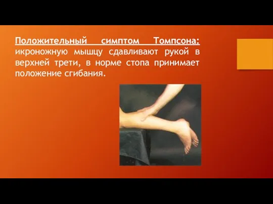 Положительный симптом Томпсона: икроножную мышцу сдавливают рукой в верхней трети, в норме стопа принимает положение сгибания.