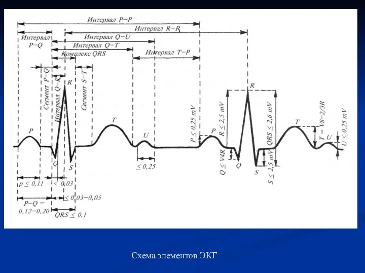 Схема элементов ЭКГ