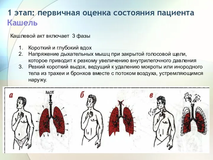 1 этап: первичная оценка состояния пациента Кашель Кашлевой акт включает