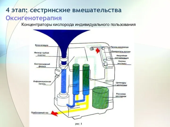 4 этап: сестринские вмешательства Оксигенотерапия Концентраторы кислорода индивидуального пользования