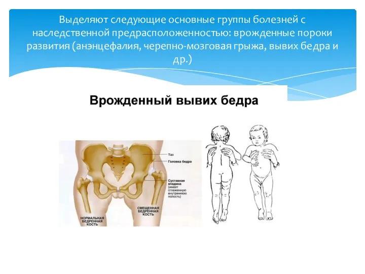 Выделяют следующие основные группы болезней с наследственной предрасположенностью: врожденные пороки