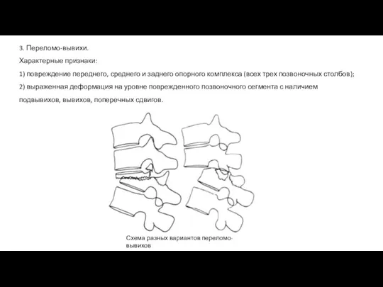 3. Переломо-вывихи. Характерные признаки: 1) повреждение переднего, среднего и заднего