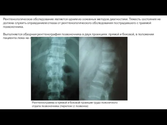 Рентгенологическое обследование является одним из основных методов диагностики. Тяжесть состояния