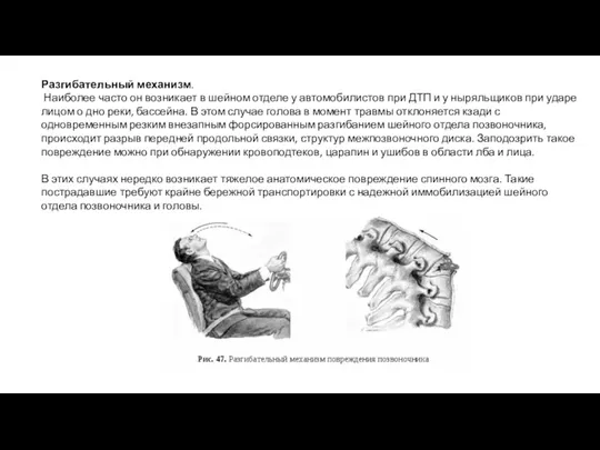 Разгибательный механизм. Наиболее часто он возникает в шейном отделе у