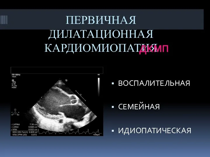 ПЕРВИЧНАЯ ДИЛАТАЦИОННАЯ КАРДИОМИОПАТИЯ ДКМП ВОСПАЛИТЕЛЬНАЯ СЕМЕЙНАЯ ИДИОПАТИЧЕСКАЯ