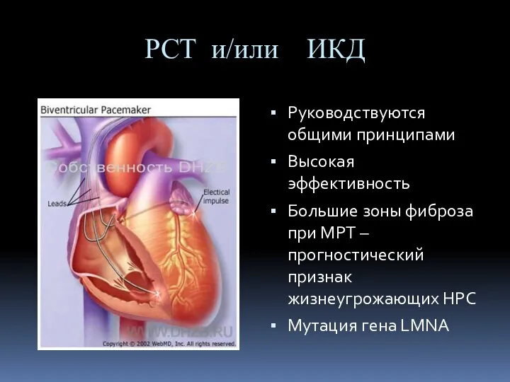 РСТ и/или ИКД Руководствуются общими принципами Высокая эффективность Большие зоны