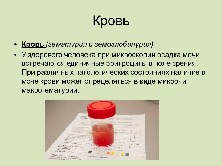 Кровь Кровь (гематурия и гемоглобинурия) У здорового человека при микроскопии