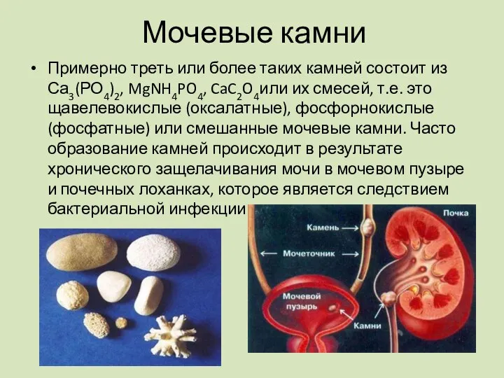 Примерно треть или более таких камней состоит из Са3(РО4)2, MgNH4PO4,