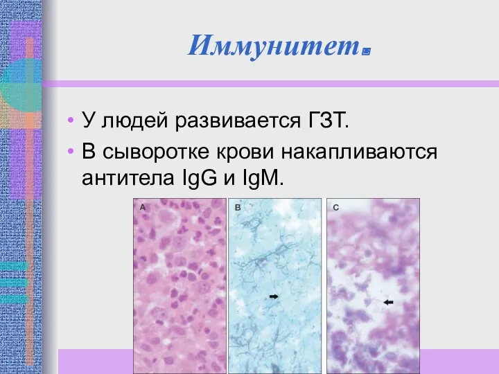 Иммунитет. У людей развивается ГЗТ. В сыворотке крови накапливаются антитела IgG и IgM.